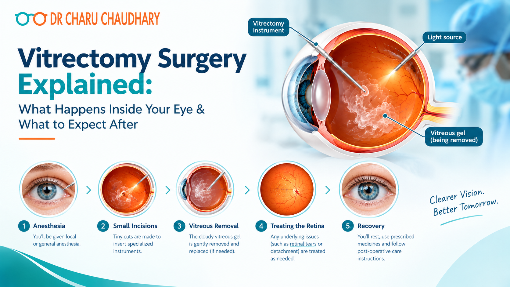 vitrectomy surgery Lucknow